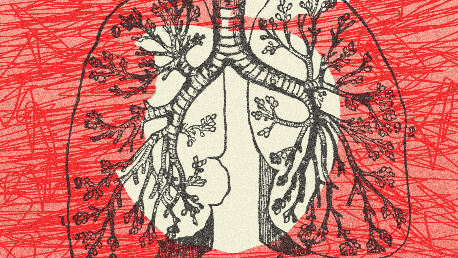 How to Use Food to Help Curb Your Asthma Symptoms