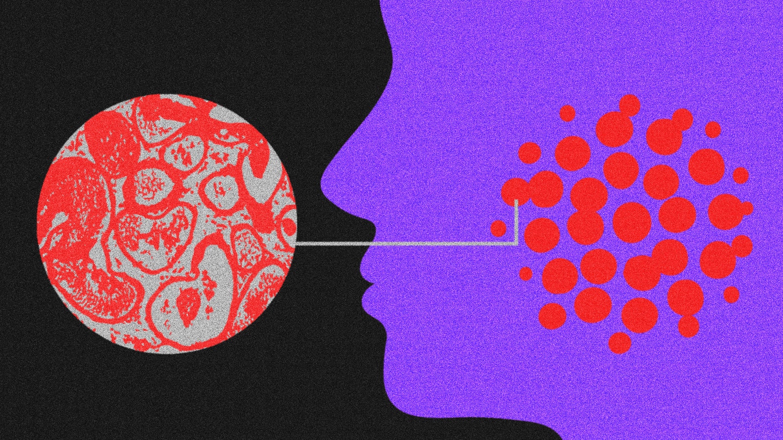 Three Signs Your ‘Acne’ Is Really a Serious Skin Condition