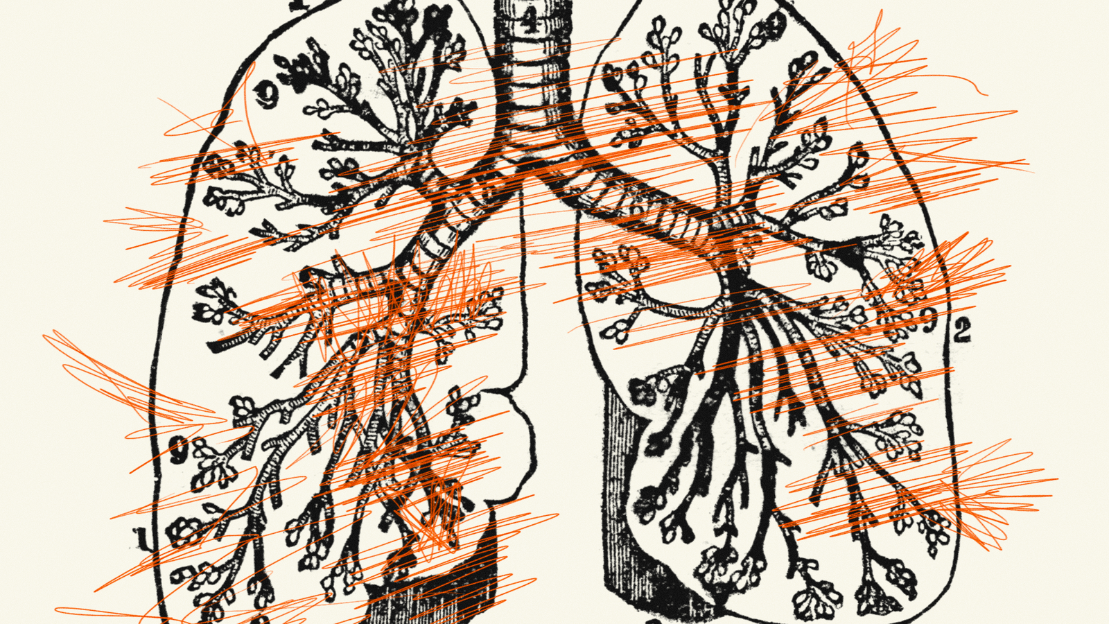7 Surprising Asthma Triggers to Know About
